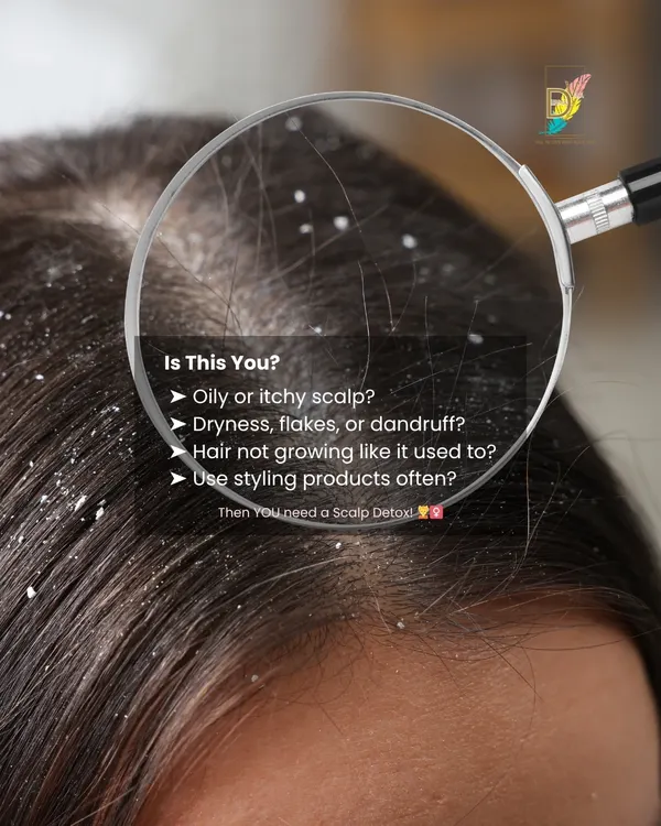 This magnified view shows the reality of a scalp suffering from dryness, flakes, and product buildup. If you have an oily or itchy scalp and notice your hair isn't growing as it used to, it's a clear sign that you need a professional scalp detox to reset its health.