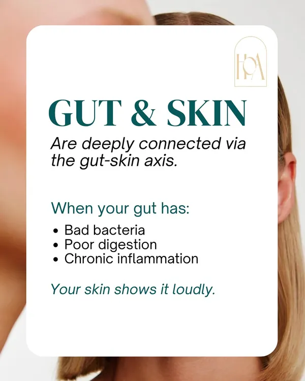 Your gut and skin are deeply connected. When your gut has bad bacteria, poor digestion, or chronic inflammation, your skin often shows it loudly through acne, redness, and other persistent issues.