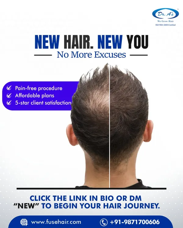 New Hair, New You. No more excuses. My procedures are pain-free, with affordable plans and a history of 5-star client satisfaction. Your journey starts here.