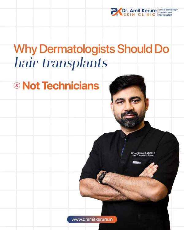 This is my core belief: hair transplants should only be done by qualified dermatologists or plastic surgeons, not technicians. My medical training ensures I understand hair biology, can manage complications, and deliver safe, aesthetic results.