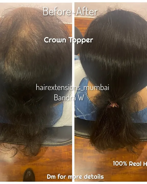 A before and after comparison showing a client with a crown topper. The piece effectively covers thinning on top and is styled into a neat ponytail, showing how it integrates with natural hair.