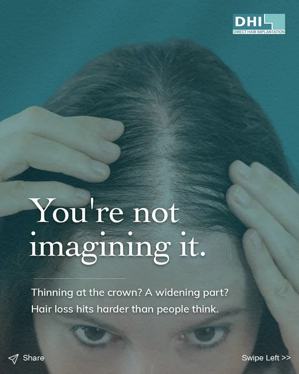"You're not imagining it." This image speaks directly to women experiencing hair loss, such as a widening part or thinning at the crown. We understand these concerns and offer expert-led treatments designed for you.
