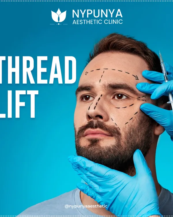 A thread lift is a minimally invasive procedure designed to lift and tighten sagging skin on the face and neck. It's an excellent non-surgical alternative for those seeking a refreshed appearance.