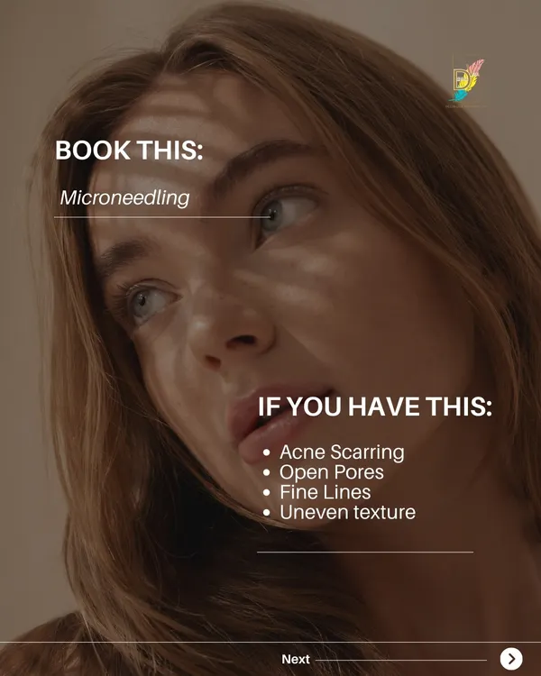 For concerns like acne scarring, open pores, and uneven texture, Microneedling is a highly effective treatment. It creates micro-injuries in the skin to trigger the body's natural collagen and elastin production, resulting in a smoother surface.