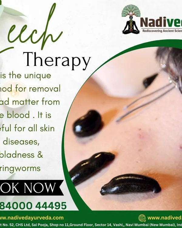 Leech therapy is a unique and highly effective method for purifying the blood. By removing impure blood, it provides remarkable benefits for skin diseases, baldness, and inflammatory conditions. This is an ancient science that delivers powerful, visible results.
