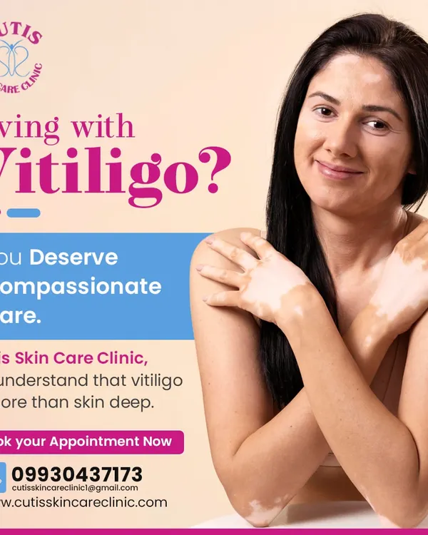 Living with vitiligo requires compassionate care, not just treatment. We understand that vitiligo is more than skin deep and combine advanced solutions with empathy to restore confidence and support your skin health journey.