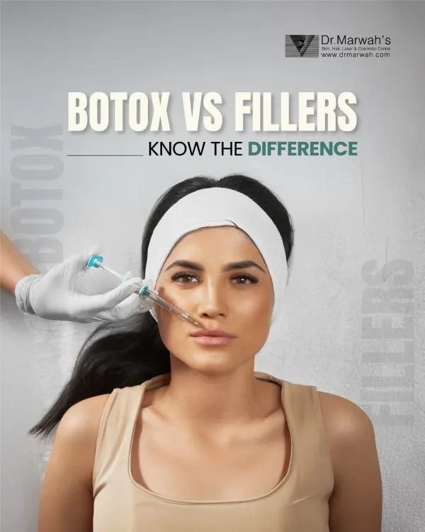 This graphic introduces a common question: Botox versus fillers. While both are injectables, they serve different purposes. This series will clarify how each treatment works to help you understand which might be right for your aesthetic goals.
