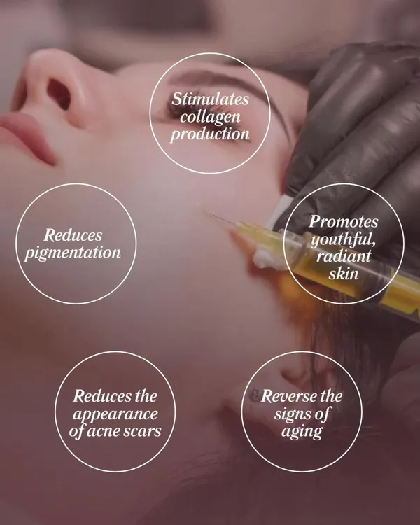 This infographic highlights the powerful benefits of our PRP (Platelet-Rich Plasma) treatment. It stimulates collagen production, reduces pigmentation and acne scars, promotes youthful skin, and reverses the signs of aging.