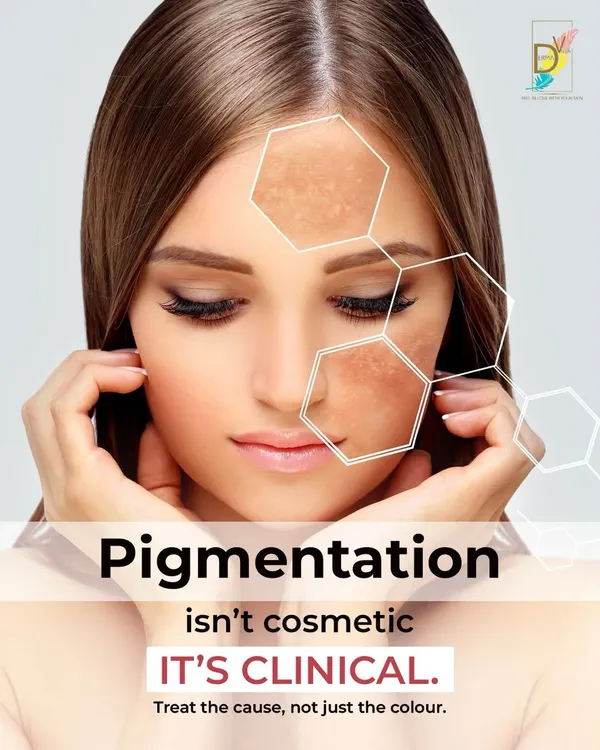 Pigmentation is a clinical issue, not just a cosmetic one. It is driven by internal triggers like hormones and inflammation. To treat it effectively, we must address the cause, not just the color on the surface. My treatments are designed to target pigmentation at its source for lasting clarity.