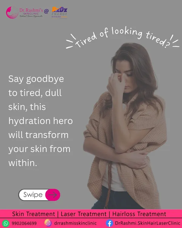 An infographic introducing Profhilo, a hydration hero treatment designed to combat tired, dull skin by working from within.