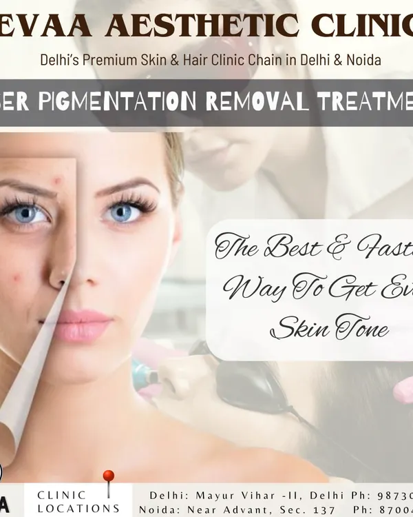 Our laser pigmentation removal treatment is the fastest way to achieve an even skin tone. This visual shows the transformation from pigmented, uneven skin to a clear, flawless complexion.