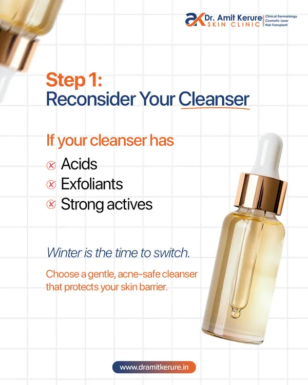 Step 1: Reconsider your cleanser. If your cleanser contains harsh acids or exfoliants, winter is the time to switch to a gentle, barrier-protecting formula.