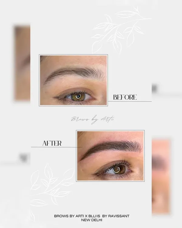 A powerful before and after comparison showcasing a complete brow transformation. The 'after' image reveals a fuller, perfectly arched brow with enhanced definition, achieved through our signature nanoblading technique by celebrity artist Arti Bagga.
