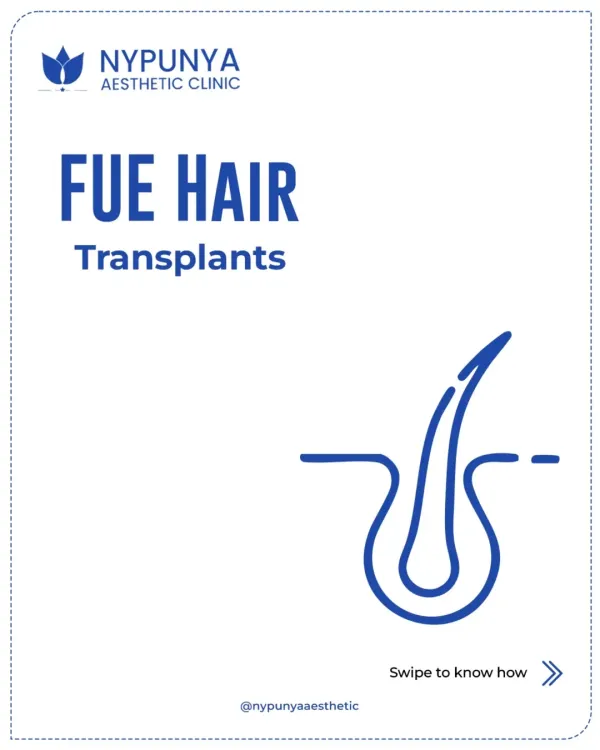 This is where the journey to restoring your hair begins. FUE, or Follicular Unit Extraction, is the most advanced hair transplant procedure I recommend for permanent, natural-looking results.