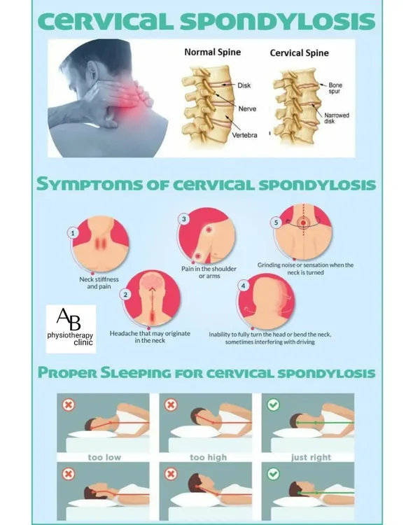 Cervical Spondylosis, or arthritis of the neck, is a common age-related condition. This guide explains its symptoms, like neck stiffness and grinding sensations, and shows the correct sleeping posture to help manage pain.