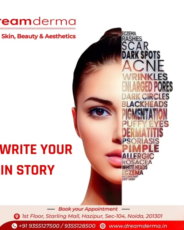 It's time to rewrite your skin story. Whether you're dealing with acne, dark spots, wrinkles, or psoriasis, this graphic shows the wide range of conditions we treat. We are here to help you start a new chapter with healthy skin.