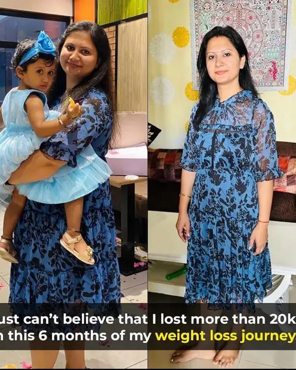 This client lost 21 kgs in 6 months after her second pregnancy. Seeing her happy and confident in her own skin is the biggest reward.
