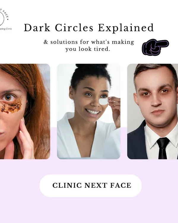 Dark circles can make you look tired even when you're not. We've explained the different causes and our targeted solutions to help you look refreshed.