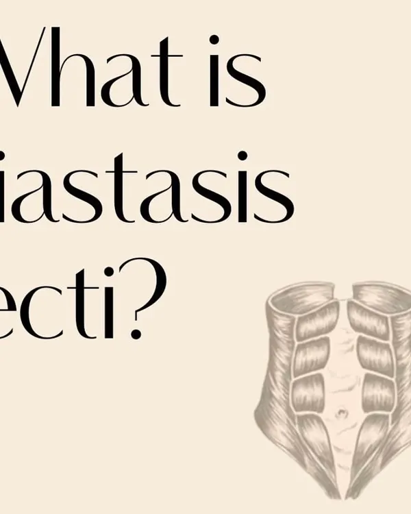 Let's talk about Diastasis Recti. This is the first part of an informational series explaining what it is. Knowledge is the first step to healing.