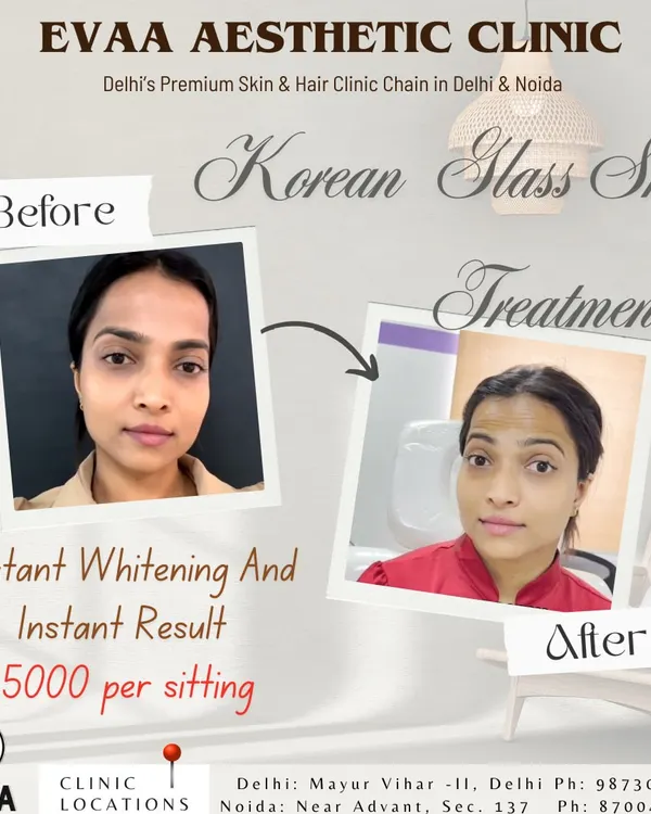 A real client's before-and-after results from our Korean Glass Skin Treatment, demonstrating instant whitening and a dramatic improvement in skin clarity and glow.