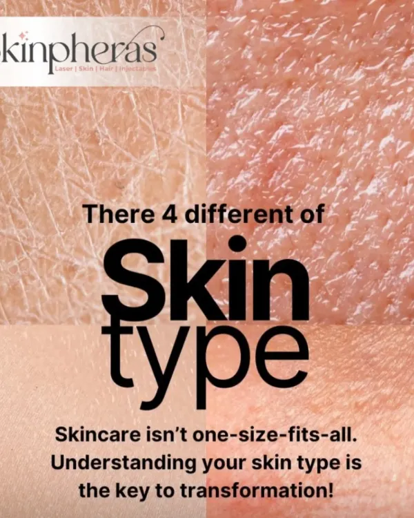 Skincare is never one-size-fits-all. This graphic introduces the four primary skin types, because understanding your specific type is the key to a successful skin transformation.