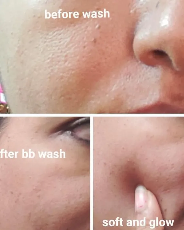 This is another wonderful result from my Gold Facial Bombs. The customer shared these pictures showing how her skin looked soft and glowing right after using the facial bomb.