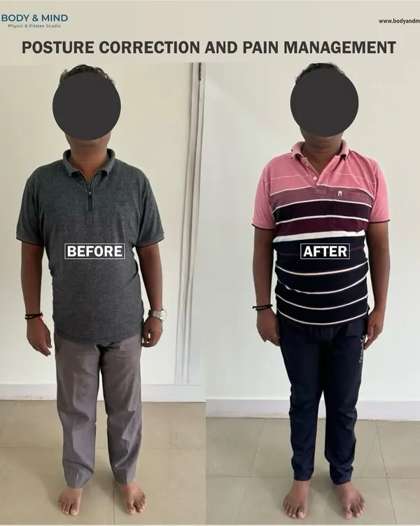 This before-and-after comparison shows the power of posture correction. By strengthening the core and realigning the spine, this client not only improved his stance but also alleviated the chronic pain associated with his previous posture.