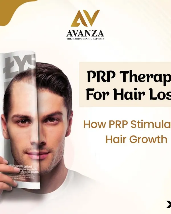 This image introduces our PRP Therapy for hair loss. It is a cutting-edge, non-surgical treatment that uses the healing power of your own blood to stimulate natural hair growth.
