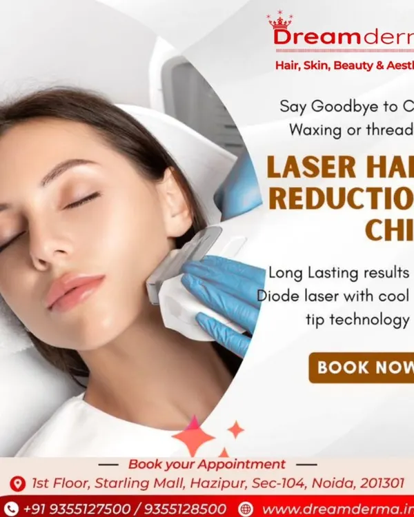 This image shows a laser hair reduction session for the chin area. I use a precise applicator to target unwanted facial hair, offering a long lasting solution with Diode laser technology that includes a cool tip for your comfort.