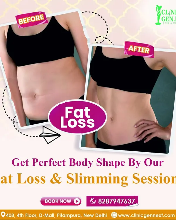 This before and after photo shows a real patient's journey with my fat loss and slimming session. You can see the significant reduction in stubborn belly fat, achieving a more contoured and defined body shape. This is the kind of result possible with CryoCool sculpting for targeted fat reduction.