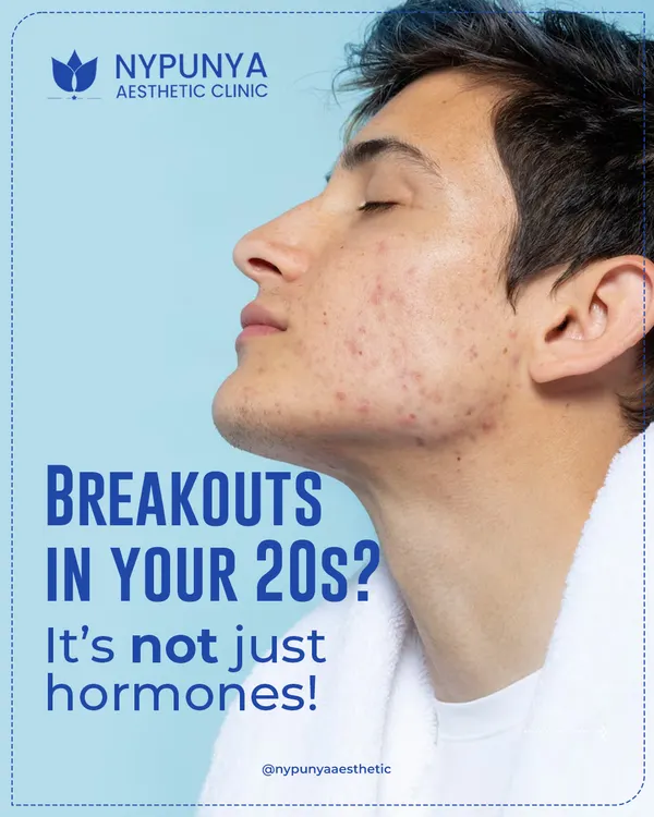 Still dealing with breakouts in your 20s and beyond? It's often not just 'teen acne'. Adult acne can be triggered by hormonal shifts, stress, and using the wrong products for your skin type.