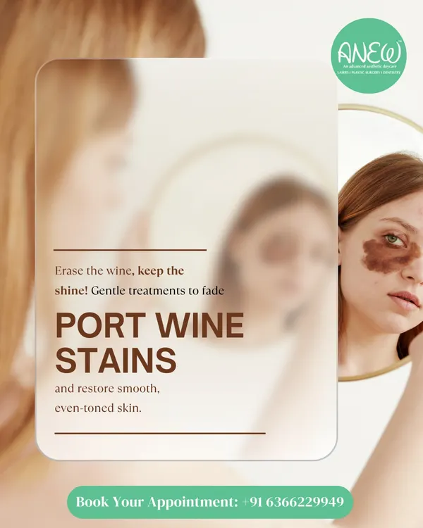 Port wine stains don't have to be permanent. I use advanced laser treatments to gently fade these stubborn stains and restore smooth, even-toned skin, helping you feel confident inside and out.