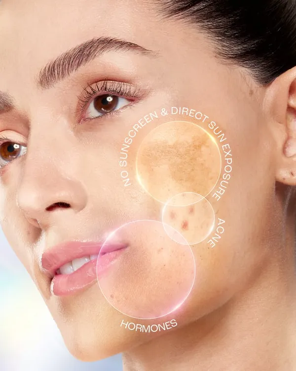 A technical beauty photograph for a Lakmé skincare product. This image uses graphic overlays to pinpoint common skin concerns like sun exposure, acne, and hormonal effects, clearly communicating the problem the product aims to solve.