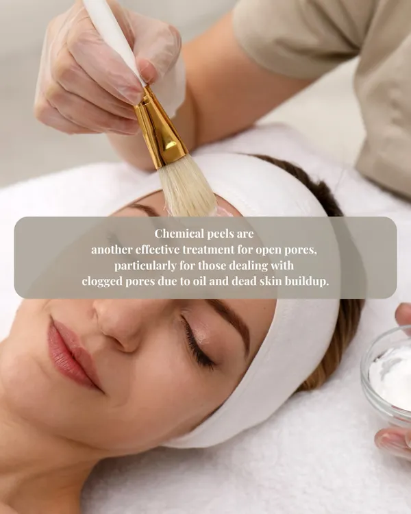 Chemical peels are a highly effective treatment for open and clogged pores caused by oil and dead skin buildup.