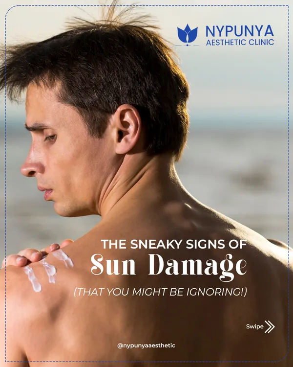Many people are ignoring the sneaky signs of sun damage. It's not just about sunburns; it's about the gradual appearance of wrinkles, pigmentation, and rough skin.