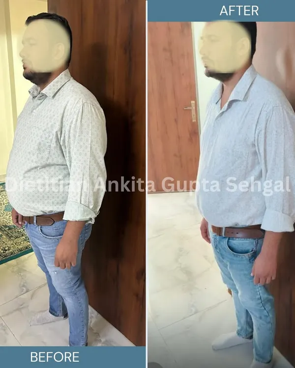 This is what real transformation looks like. In just 90 days, with a personalized diet plan using simple home-cooked meals, my client Haris not only lost 10 kgs but also saw his HbA1c drop from a diabetic 9.9 to a healthy 4.9. This is the power of the right food.