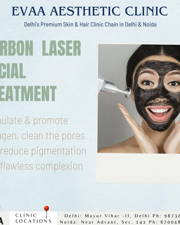 A visual of our Carbon Laser Facial treatment, a procedure that stimulates collagen, cleans pores, and reduces pigmentation to deliver a flawless complexion.