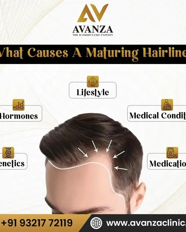 A maturing hairline is influenced by multiple factors. This graphic illustrates the primary causes we investigate during a consultation, including genetics, hormones, lifestyle, medical conditions, and medications.