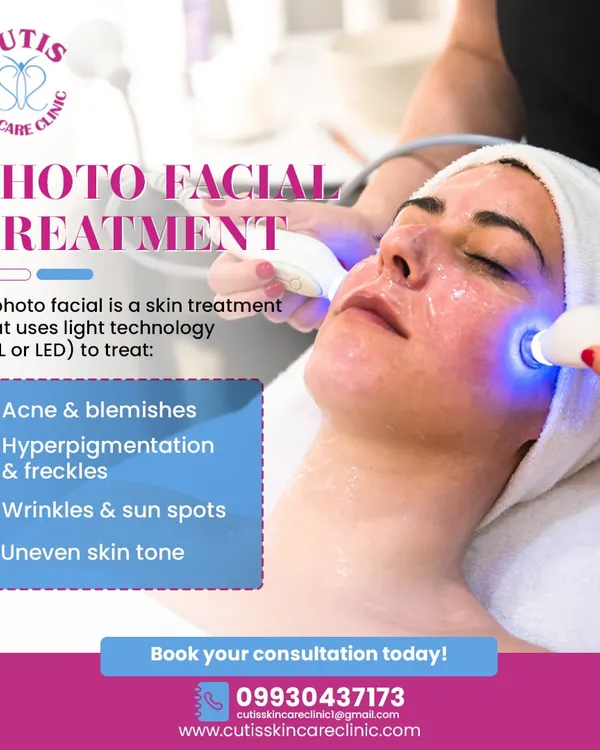 A detailed look at a Photo Facial treatment in progress. The graphic explains how we use light technology (IPL or LED) to treat a variety of concerns, including acne, hyperpigmentation, wrinkles, and uneven skin tone.