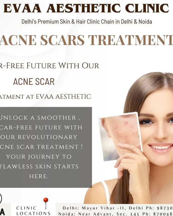 An introduction to our revolutionary acne scar treatments, designed to give you a smoother, scar-free future. We focus on creating flawless skin by addressing the texture and pigmentation left by old breakouts.