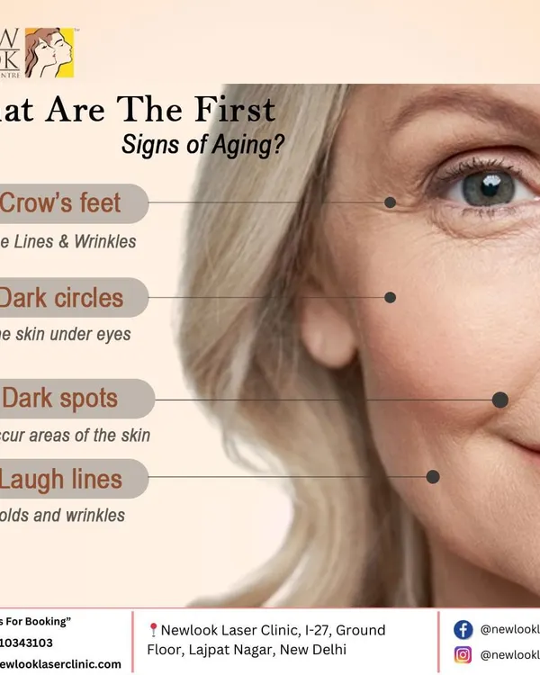 This educational graphic points out the first signs of aging that we commonly treat. From dark spots and circles to fine lines, our advanced laser and skin treatments are designed to effectively address these concerns and rejuvenate your skin.