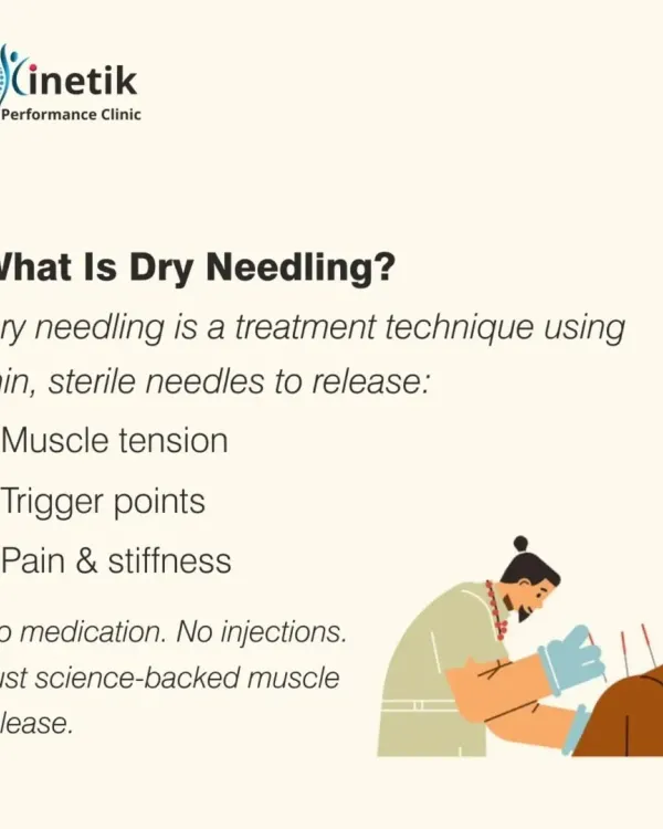 What is Dry Needling? It is a modern treatment technique that uses thin, sterile needles to release muscle tension, trigger points, and stiffness. There is no medication injected; it is a science-backed method for targeted muscle release.