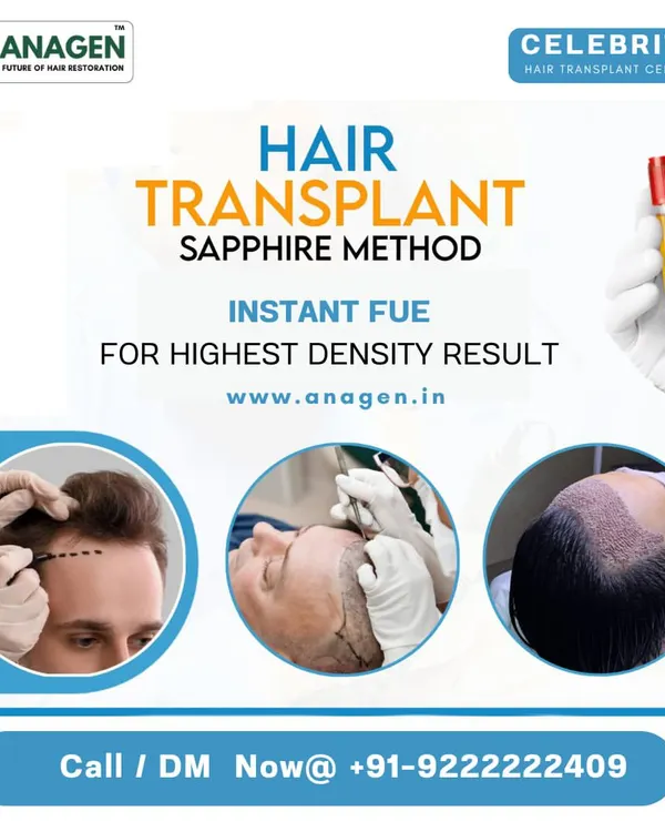 We use the Sapphire method and Instant FUE to achieve the highest density results. This combination allows for precise, scar free implantation and better graft survival, giving you a fuller, more natural look.
