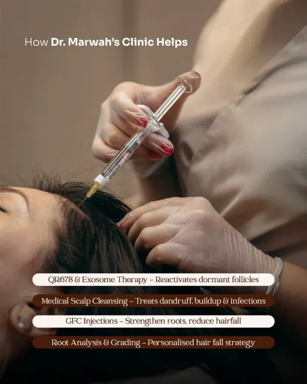 This image shows a GFC (Growth Factor Concentrate) injection being administered. This non-surgical therapy strengthens hair roots and reduces hair fall by delivering your body's own healing proteins directly to the scalp.