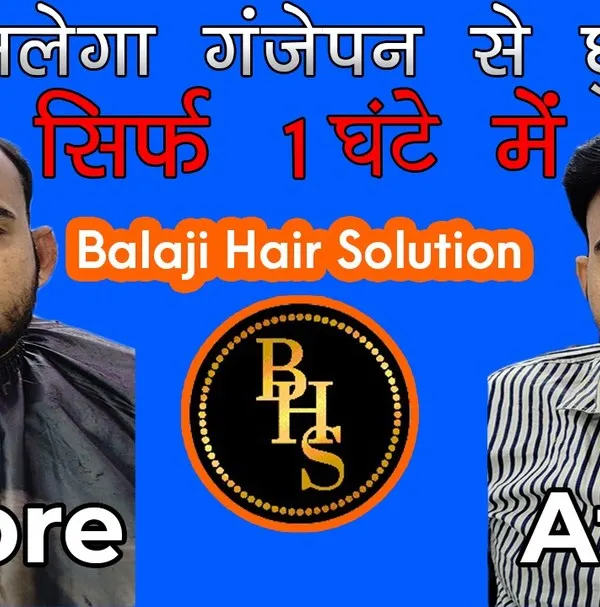 Dekhiye ye kamaal ka transformation. With our expert hair patch service, you can get freedom from baldness, or 'ganjepan se chhutkara', in just about an hour. We provide a new look and renewed confidence.
