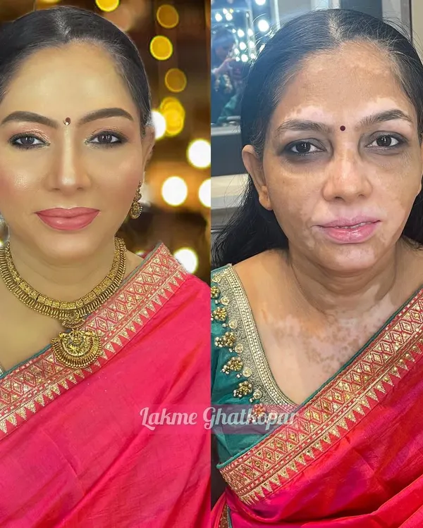 I believe makeup has the power to transform and empower. In my courses, you will learn specialized corrective techniques to master any challenge, including working with vitiligo and mature skin, ensuring every client feels flawless and confident.