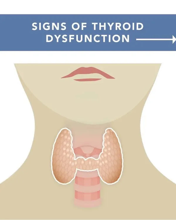The thyroid gland is a master regulator of your metabolism, fertility, and energy. Understanding the signs of thyroid dysfunction is the first step toward seeking a proper diagnosis and creating a plan to restore its function.
