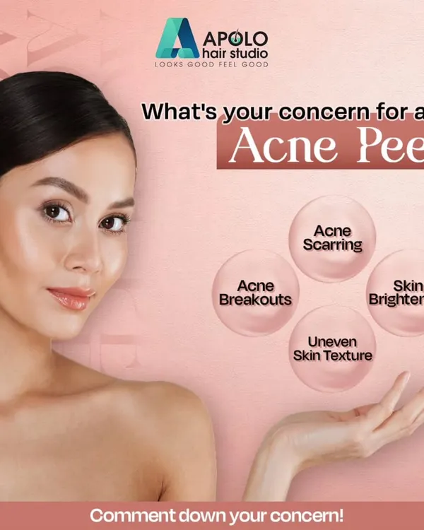 What is your main skin concern? This graphic breaks down how a professional Acne Peel can target specific issues, whether it's persistent breakouts, leftover acne scarring, uneven texture, or a desire for overall skin brightening.