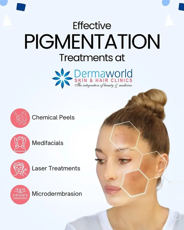 Pigmentation is a very common concern, but it can be treated effectively with the right approach. At my clinic, I use a combination of treatments like chemical peels, medifacials, and advanced laser therapies to break down excess pigment and reveal an even, clear complexion.