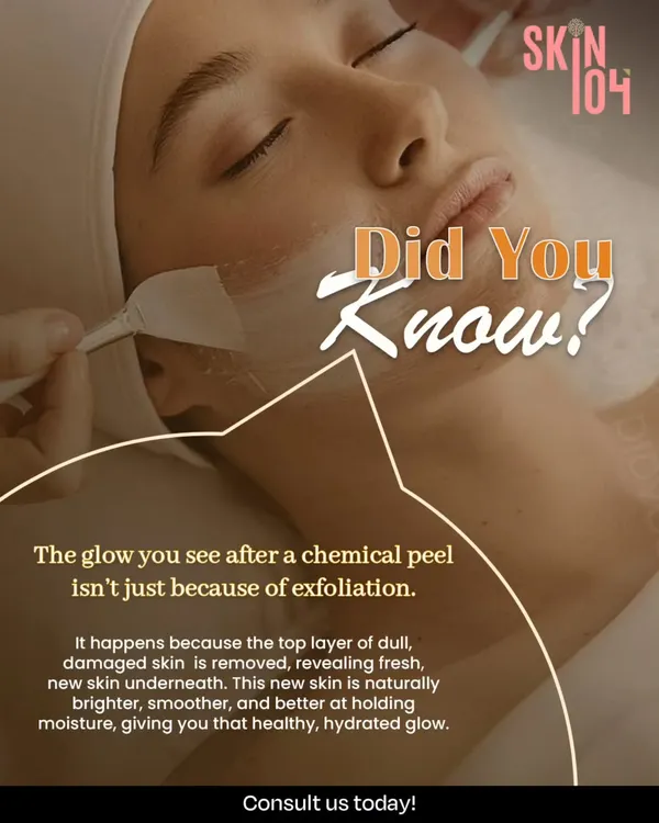 Did you know the glow from a chemical peel isn't just from exfoliation? By removing the top layer of dull, damaged skin, we reveal fresh, new skin that is naturally brighter and better at holding moisture.